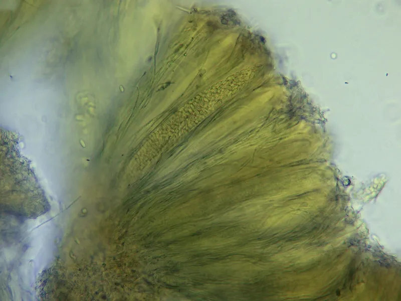 Biatorella fossarum 11 - Himenio Melzer x 400-001